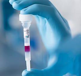 Protein Purification